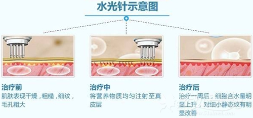 这些水光基础常识的小科普、你知道吗？